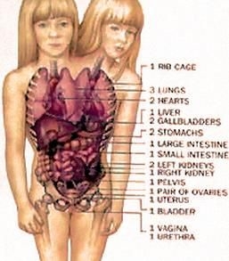 Body-structure-of-Brittany-and-Abby-Hansel.jpg